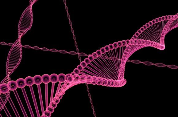 huntington disease